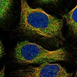 DGLUCY Antibody, Novus Biologicals 25 &mu;L; Unlabeled:Antibodies, Polyclonal